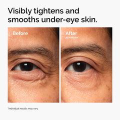 The Ordinary Lacto-PDRN* 4% + B9 Eye Cream – 15ml