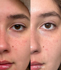 Bubble Star Dew HYDRATING EYE CREAM