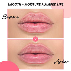 Soo'AE COLLAGEN - My Collagen Hydrogel Lip Patch