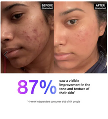 The INKEY List 15% Vitamin C and EGF Brightening Serum (30 ml)