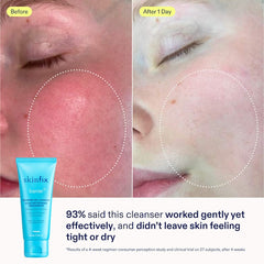 SkinFix Nourishing Cleanse + Moisturize Skin Set