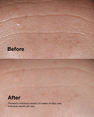 Clinique Smart De-Ageing Duo Set