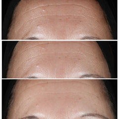 Clinique Smart Clinical Repair Wrinkle Correcting Serum (10ML) - Travel Size