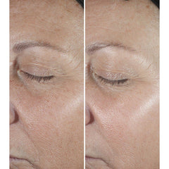 Clinique Smart Clinical Repair Wrinkle Correcting Serum (10ML) - Travel Size